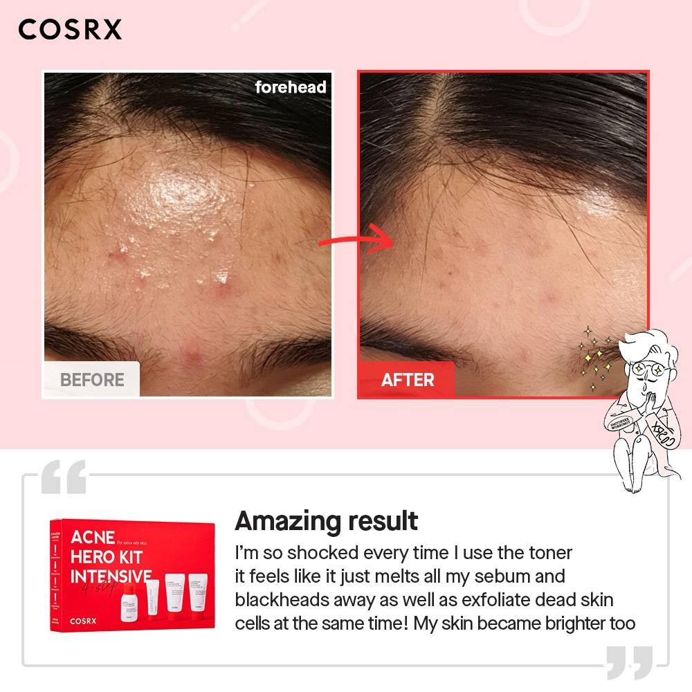 COSRX - ACNE HERO KIT INTENSIVE - DISCOVERY SET 4 STEPS