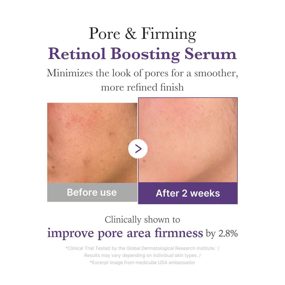 MEDICUBE RETINOL NMN BOOSTING SERUM 1.9% 30 ML