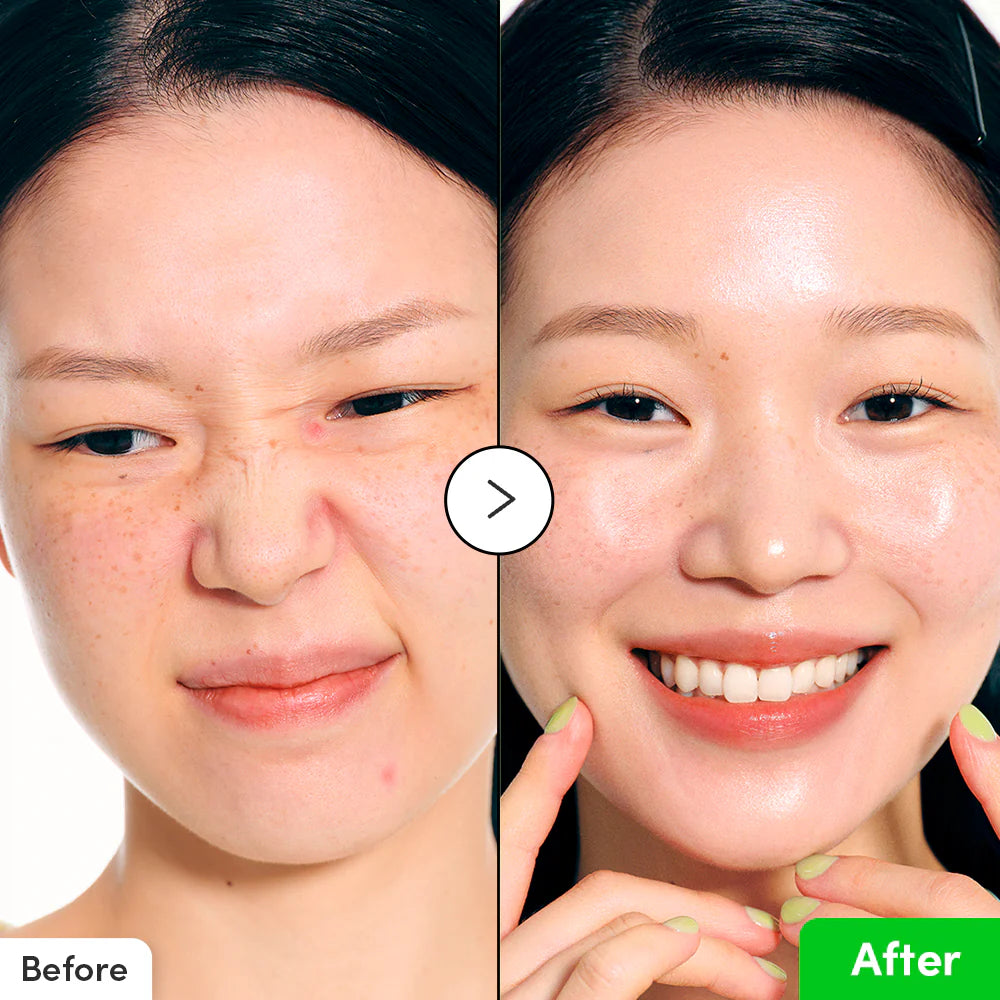 EQQUALBERRY ALOE PDRN CALMING SERUM 30 ML