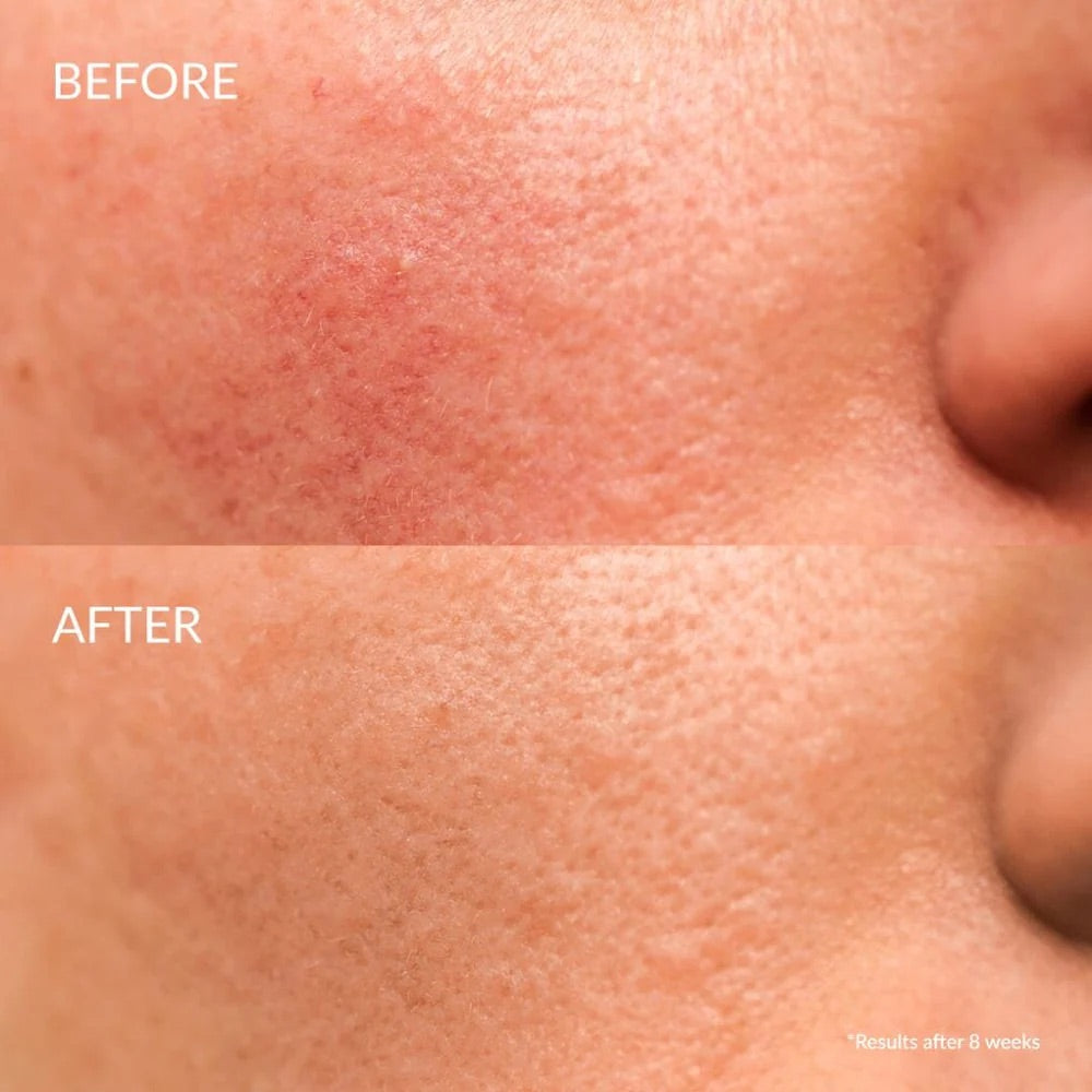 IREN SHIZEN KEEP CALM SÉRUM APAISANT