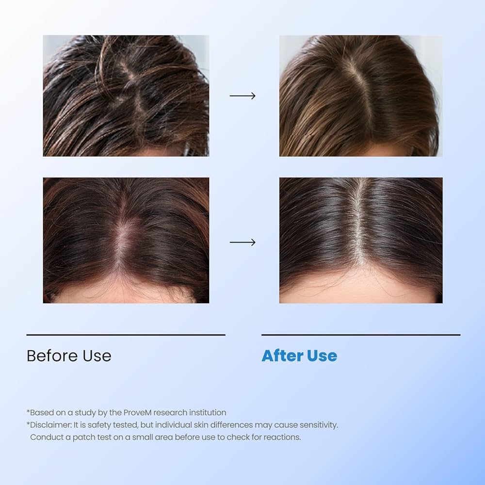 SEAPURI SCALPY BUBBLE TONIC-TONIQUE CUIR CHEVELU ANTI CHUTE EXFOLIANT