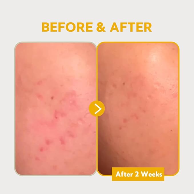 TIRTIR PURE VITAMIN C 24% SERUM 30ml