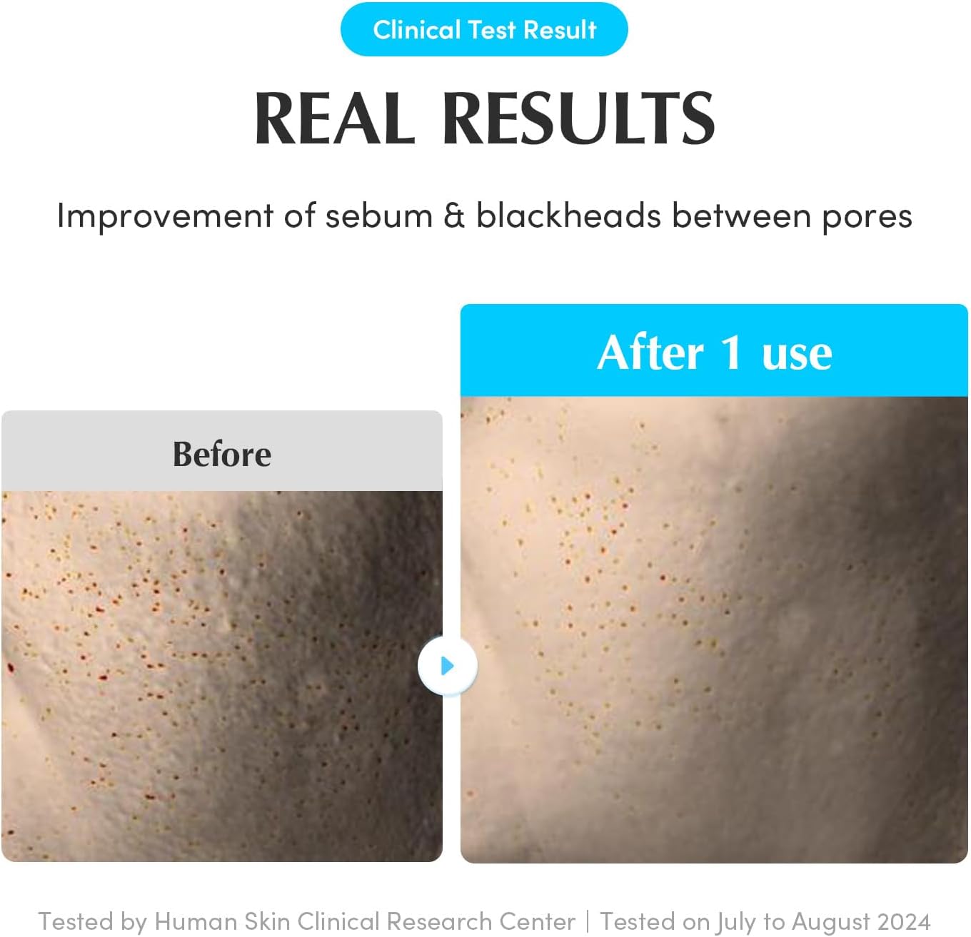 EQQUALBERRY SWIMMING POOL TONER PADS 220ML 70 PADS