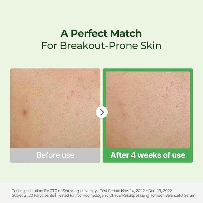 TORRIDEN BALANCEFUL CICA SERUM 50ML