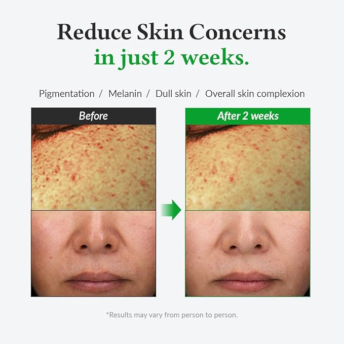 DR.ALTHEA GENTLE VITAMIN C 20% SERUM 30ML