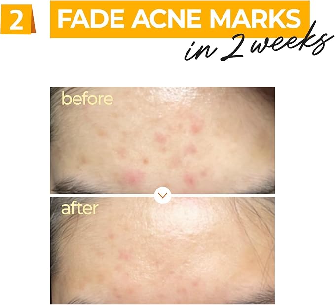 NUMBUZIN NO.5+ SÉRUM CONCENTRÉ DE VITAMINES 30ML