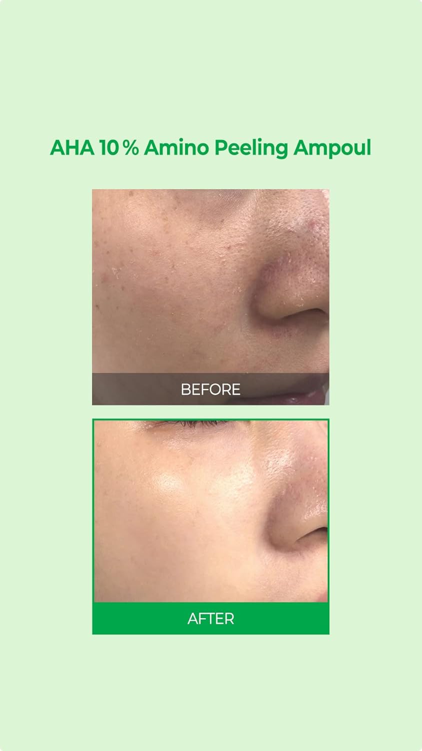 SOME BY MI AHA 10% AMINO PEELING AMPOULE 35 ML