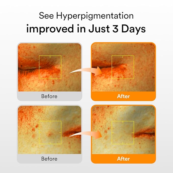 ABIB GLUTATHIOSOME DARK SPOT SERUM 50ML