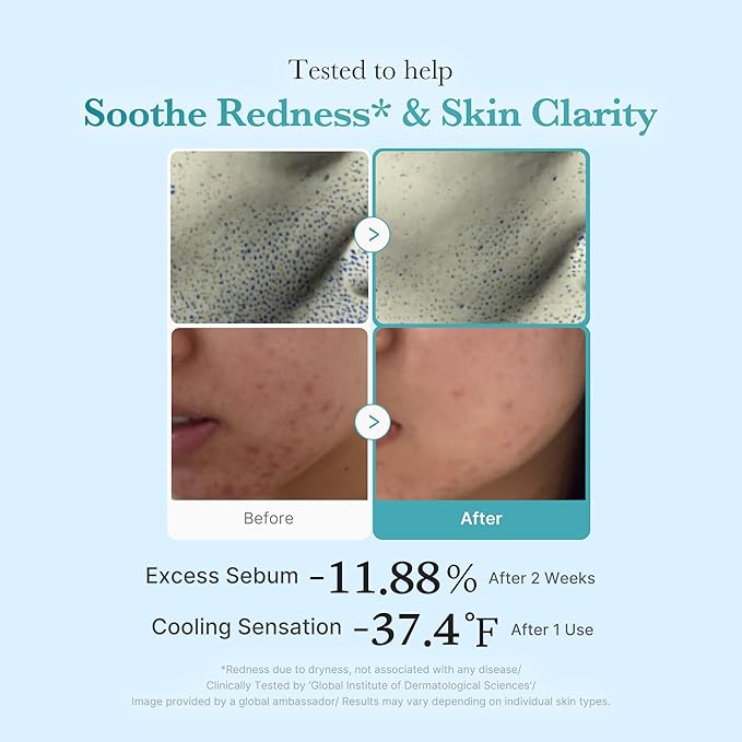 MEDICUBE AZELAIC ACID NIACINAMIDE CLEAR TONER 4% 250 ML