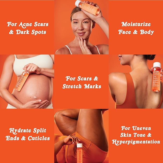 BIO-OIL SPECIALIST SKIN CARE OIL - SCARS, STRETCH MARK PRODUCT