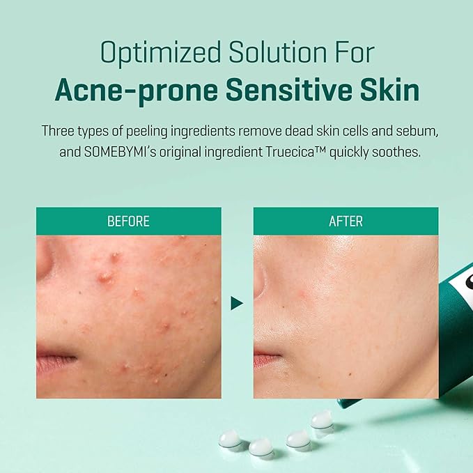 SOME BY MI CRÈME ANTI-BOUTONS SUPER MIRACLE 14 JOURS AUX BHA AHA PHA 30ML