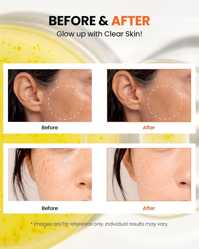 K-SECRET SEOUL 1988 GLOW SERUM NIACINAMIDE 15% + YUJA 30ML