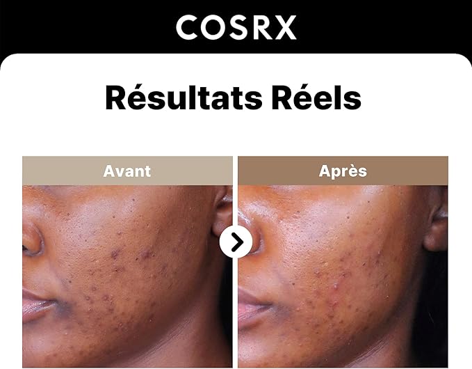 COSRX ALPHA ARBUTIN 2 DISCOLORATION CARE SERUM 50ML