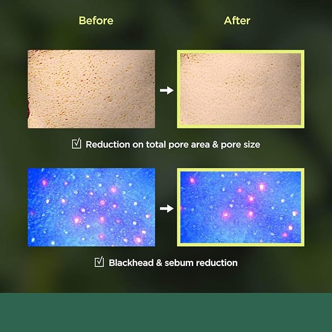 ANUA - HEARTLEAF 77 CLEAR PAD - COMPRESSES PURIFIANTES