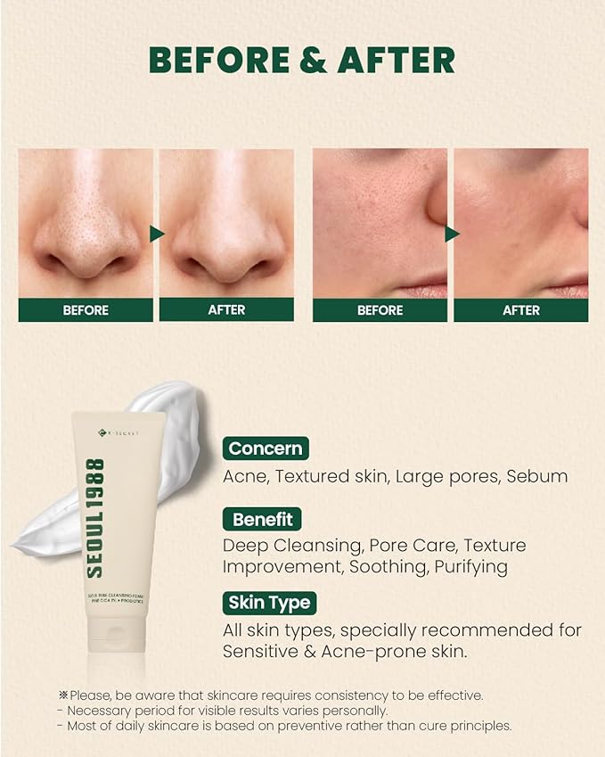 K-SECRET SEOUL 1988 CLEANSING FOAM : PINE CICA 1% + PROBIOTICS 150ML