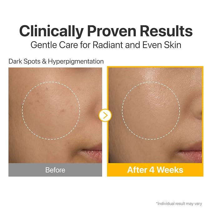 NUMBUZIN NO.5+ SÉRUM CONCENTRÉ DE VITAMINES 30ML