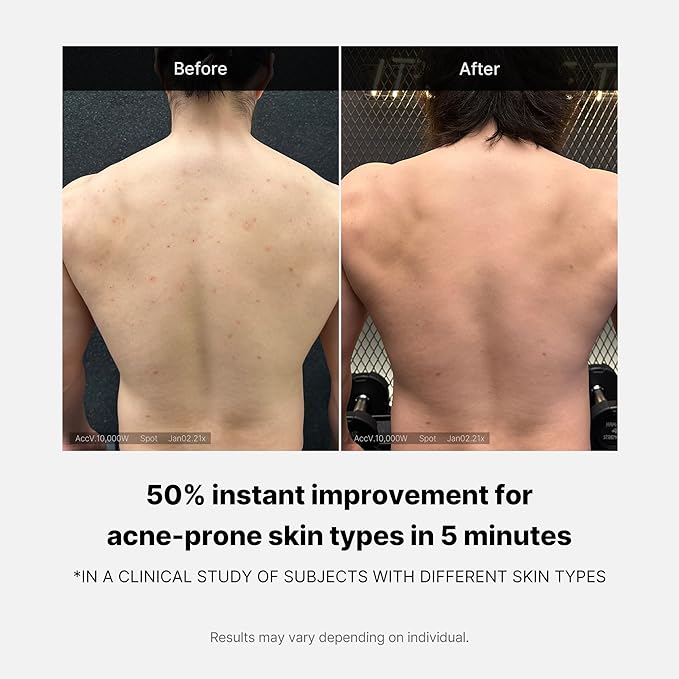 MEDICUBE RED ACNE BODY WASH AHA BHA PHA NIACINAMIDE 400G