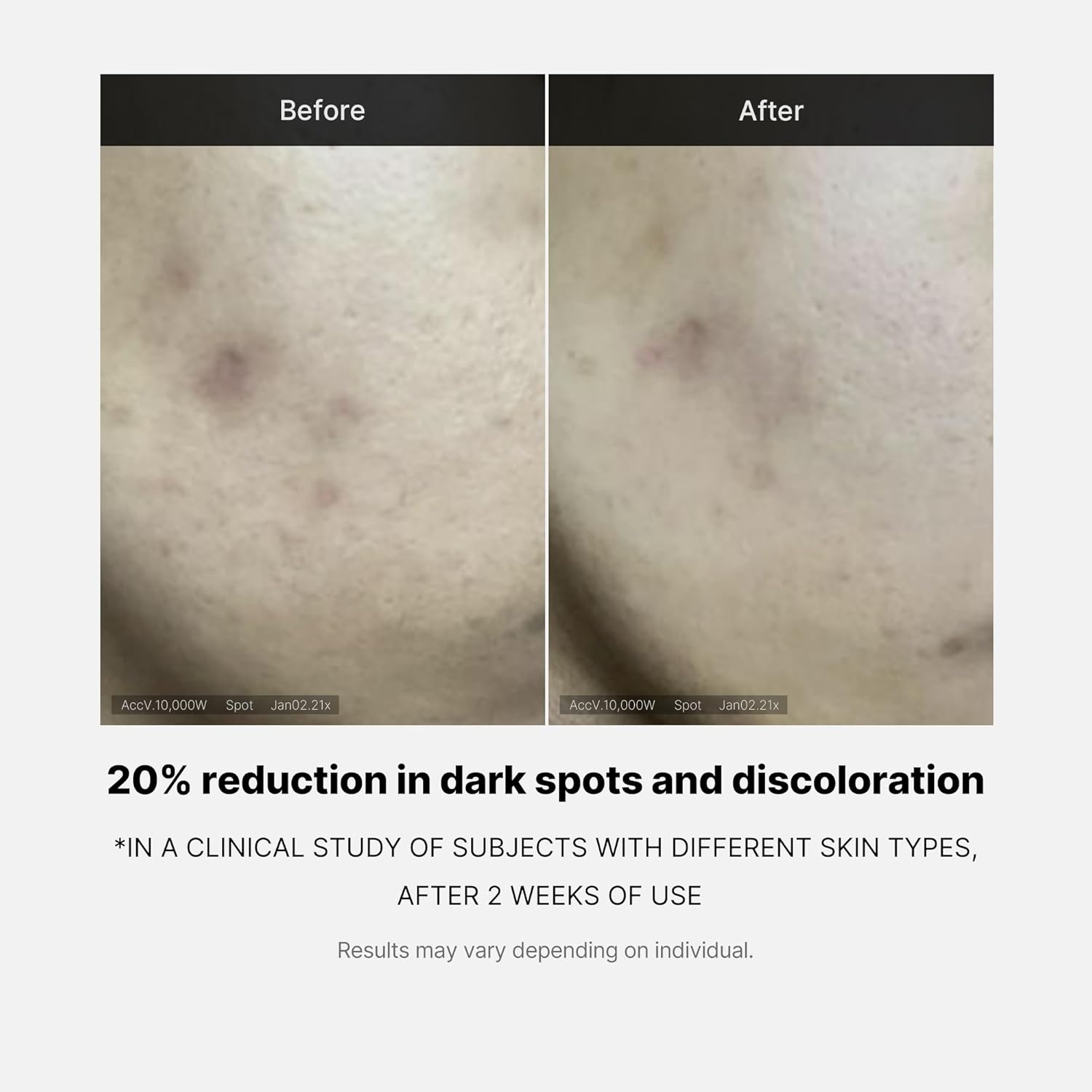 MEDICUBE DEEP VITA C AMPOULE 14,5% (10GX3)