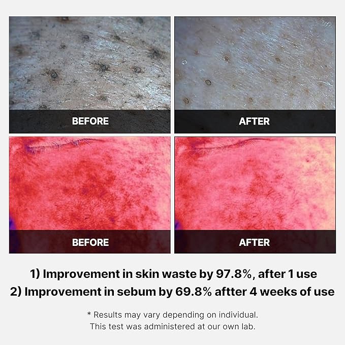 MEDICUBE RED SUCCINIC ACID PEELING PADS 155G