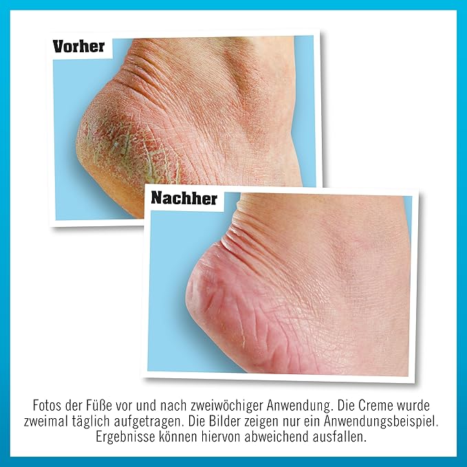 O'KEEFFE'S HEALTHY FEET CRÈME POUR LES PIEDS 91 G