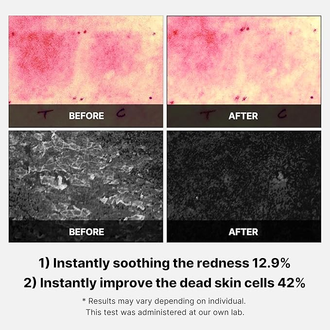 MEDICUBE SUPER CICA PAD 150G