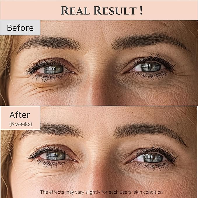 BEAUTY OF JOSEON - SÉRUM CONTOUR DES YEUX 30ML