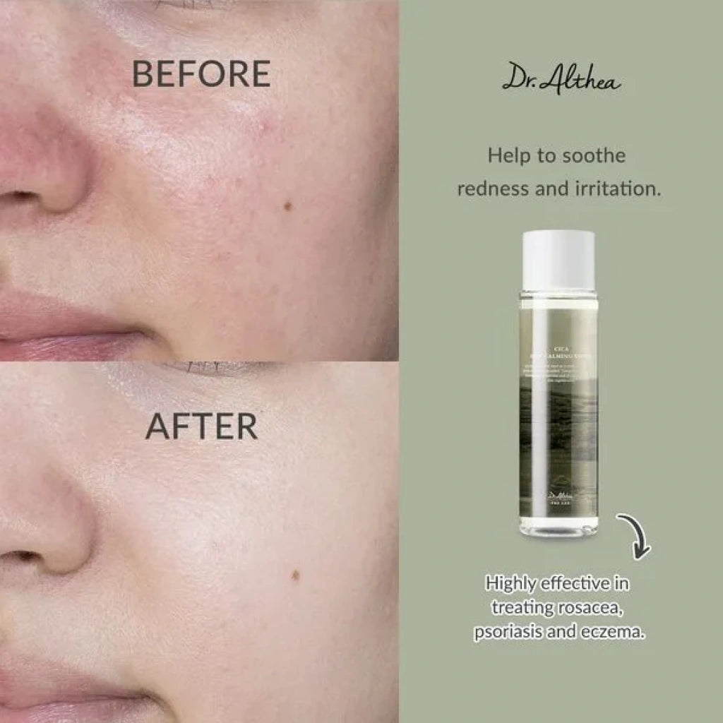 DR. ALTHEA ANASTATICA SKIN CONDITIONING TONER 250ML
