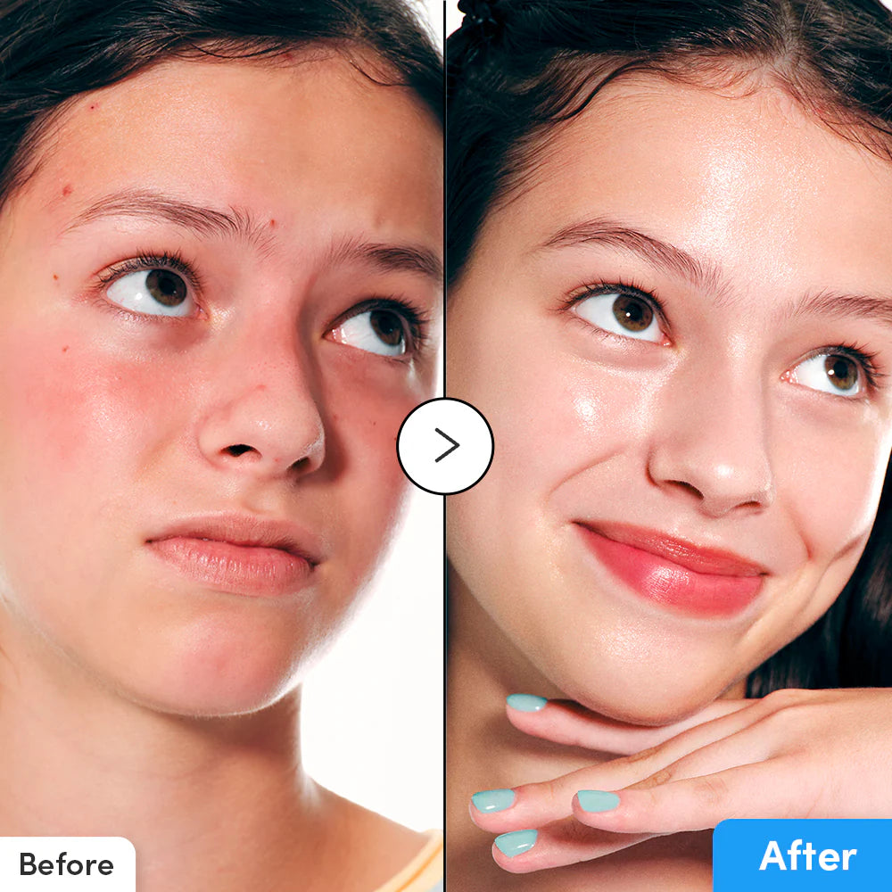 EQQUALBERRY HYALTOIN FLOODING SERUM 30 ML