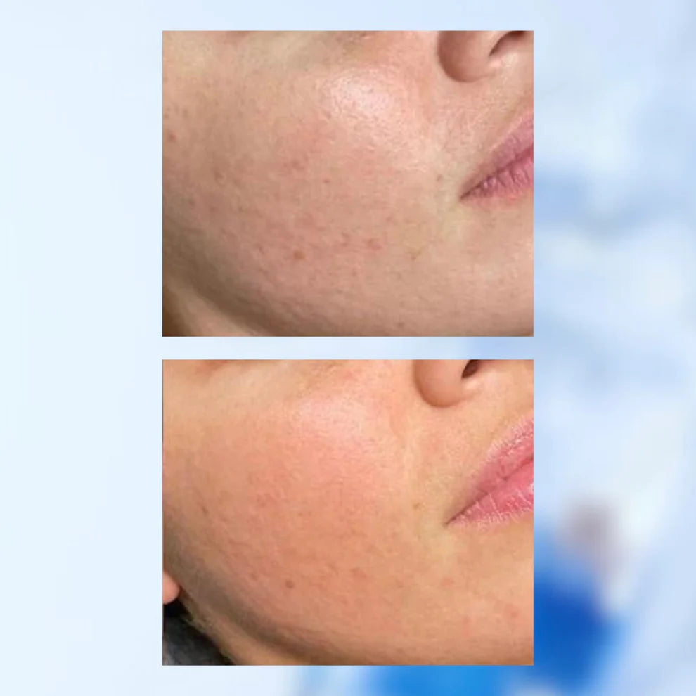 MIXSOON - SÉRUM À L'ACIDE HYALURONIQUE À L'EAU DE GLACIER - 300ML