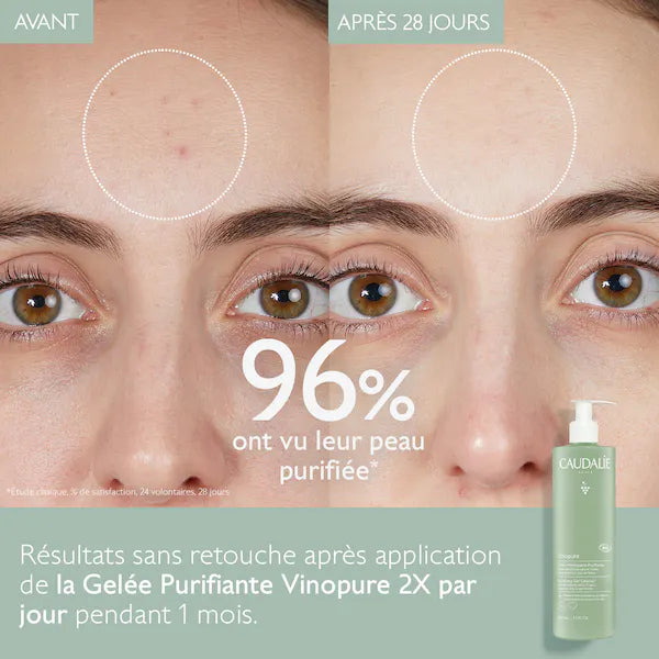 CAUDALIE VINOPURE GÈLEE NETTOYANTE PURIFIANTE ANTI ACNÉ