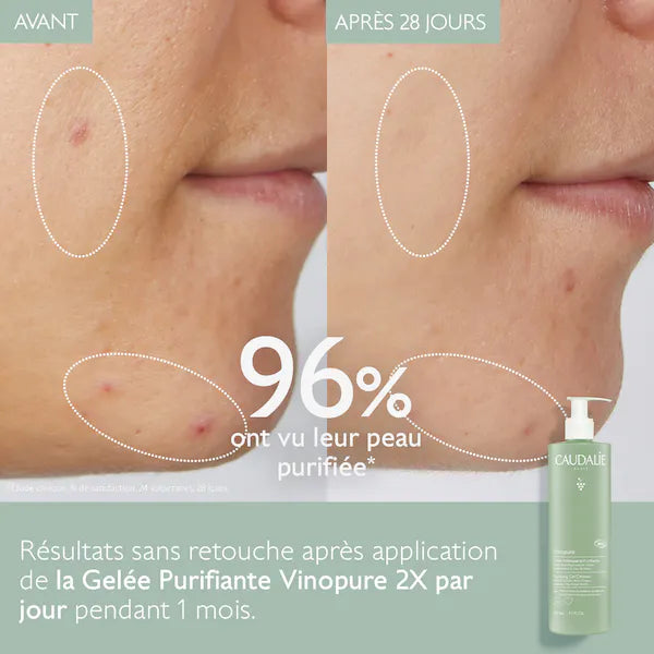 CAUDALIE VINOPURE GÈLEE NETTOYANTE PURIFIANTE ANTI ACNÉ