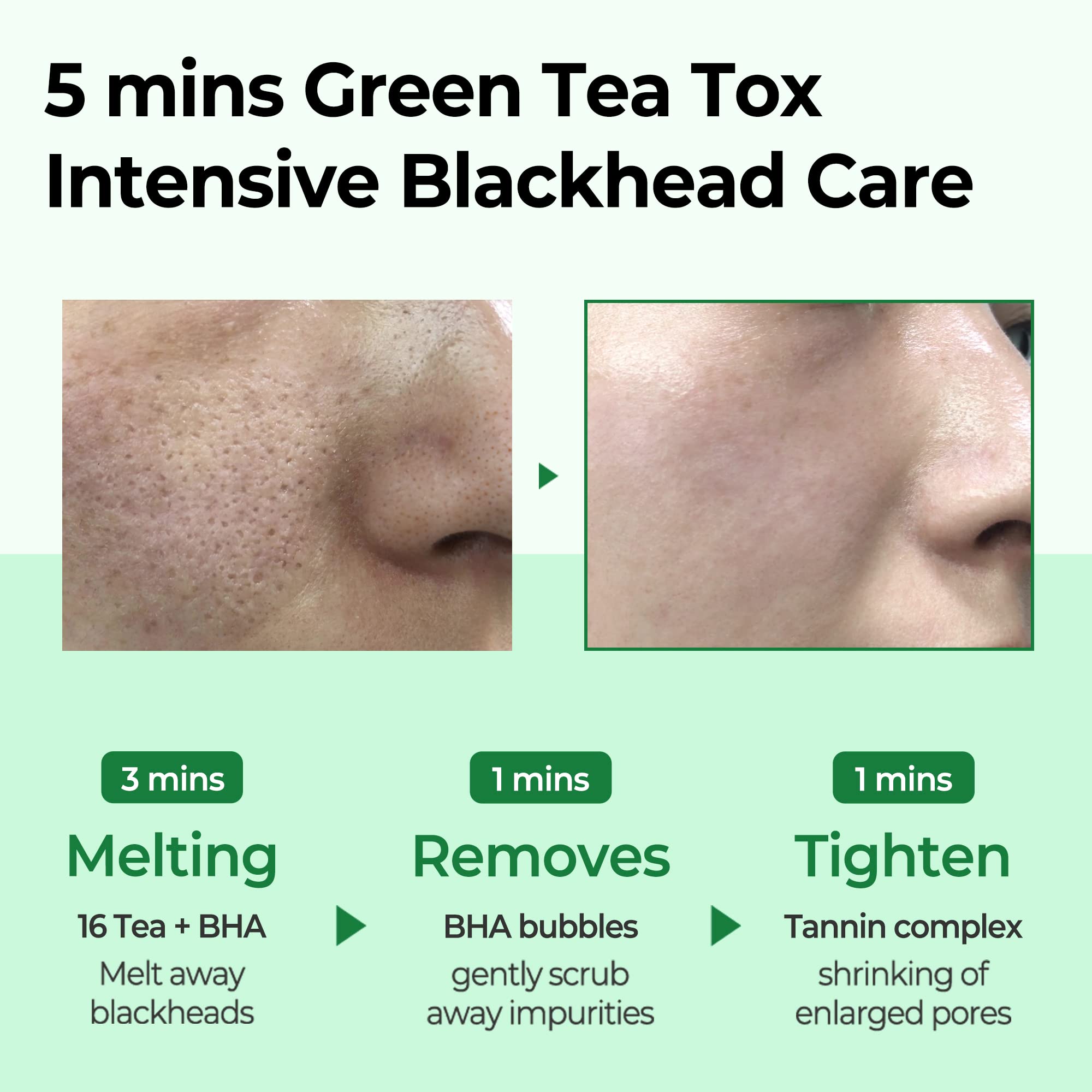SOME BY MI- BYE BYE BLACKHEAD 30 DAYS MIRACLE GREEN TEA TOX BUBBLE CLEANSER 120ML