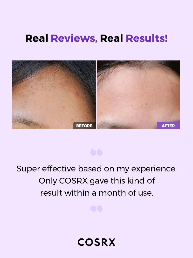 COSRX AHA/BHA CLARIFYING TREATMENT TONER ( ANTI BOUTONS ET POINTS NOIRS) 150ML