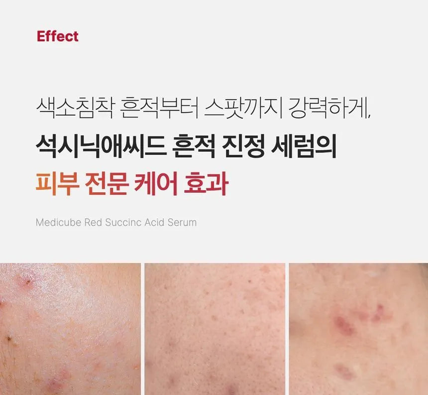 MEDICUBE RED SUCCINIC ACID SERUM 30ML