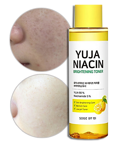 SOME BY MI TONER ÉCLAIRCISSANT YUJA NIACIN 150 ML