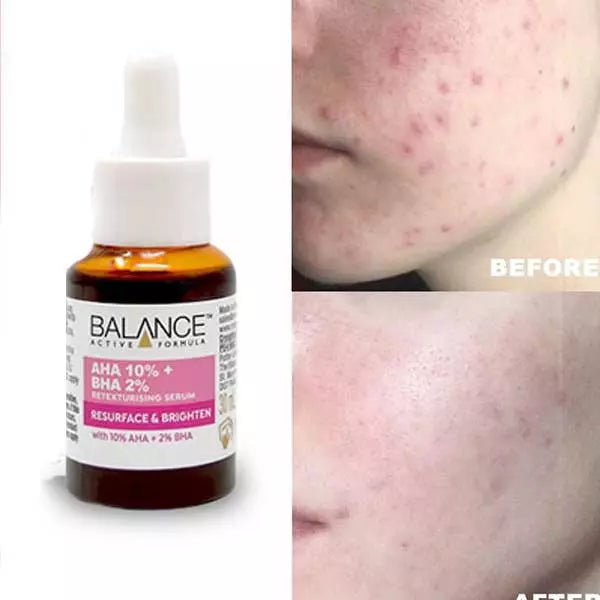 BALANCE ACTIVE FORMULA AHA 10 BHA 2 RESURFACE & BRIGHTEN SERUM 30ML