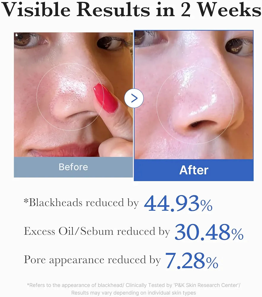 MEDICUBE ZERO PORE PAD 155G/ 70 PADS