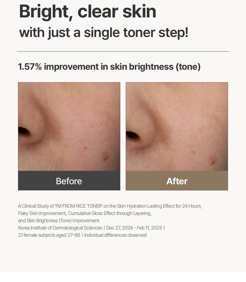 I'M FROM RICE TONER 150 ML (NEW)