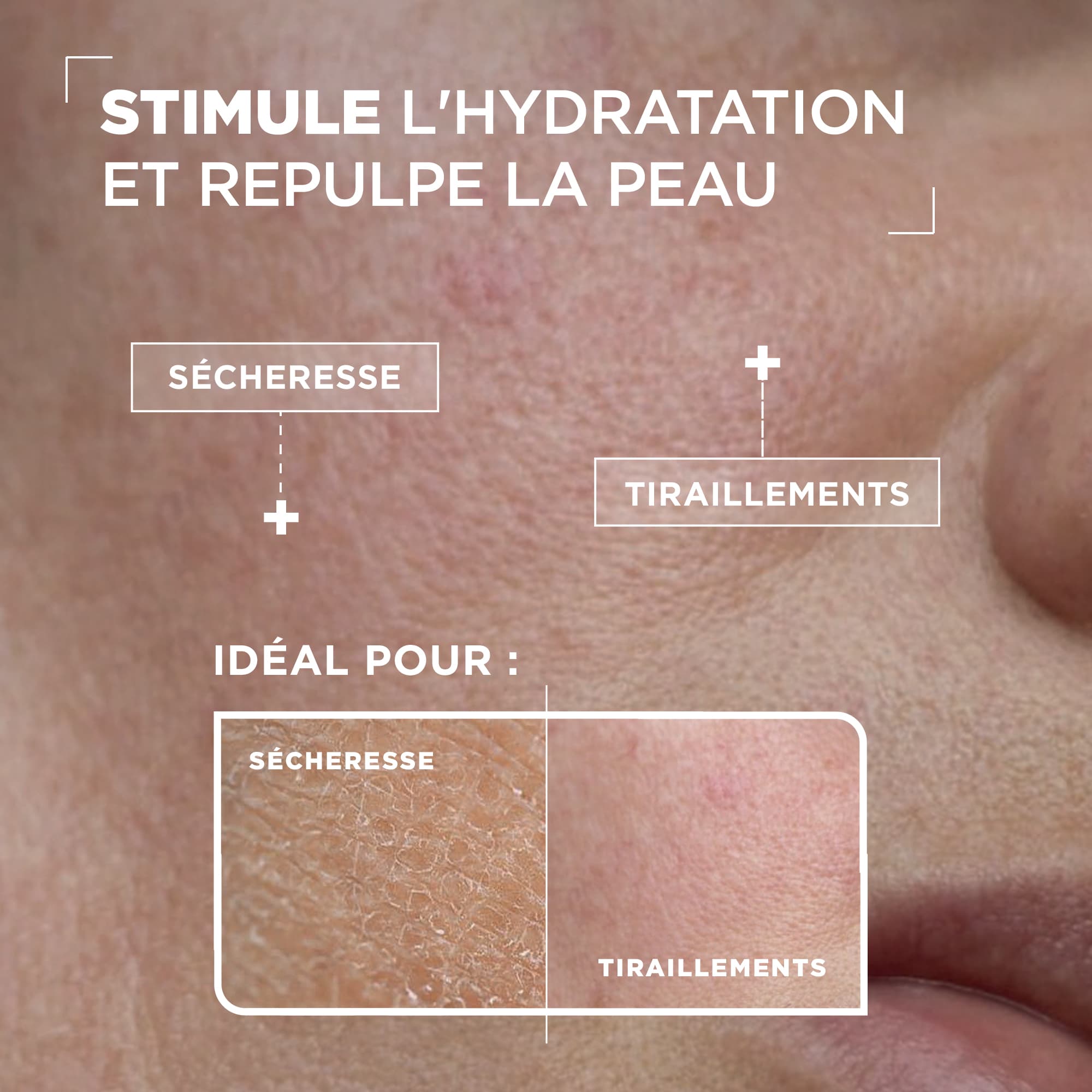 MIXA SÉRUM RÉHYDRATANT ACIDE HYALURONIC+ACIDE LACTIQUE 30ML