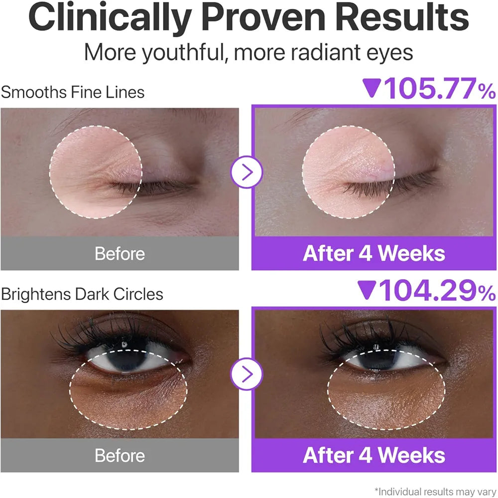NUMBUZIN NAD+RETINOL VOLUMETOX EYE CREAM 10ML