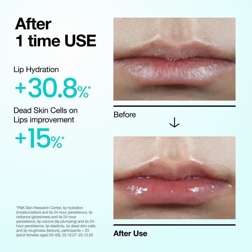 ANUA PDRN HYALURONIC LIP SERUM 10ML