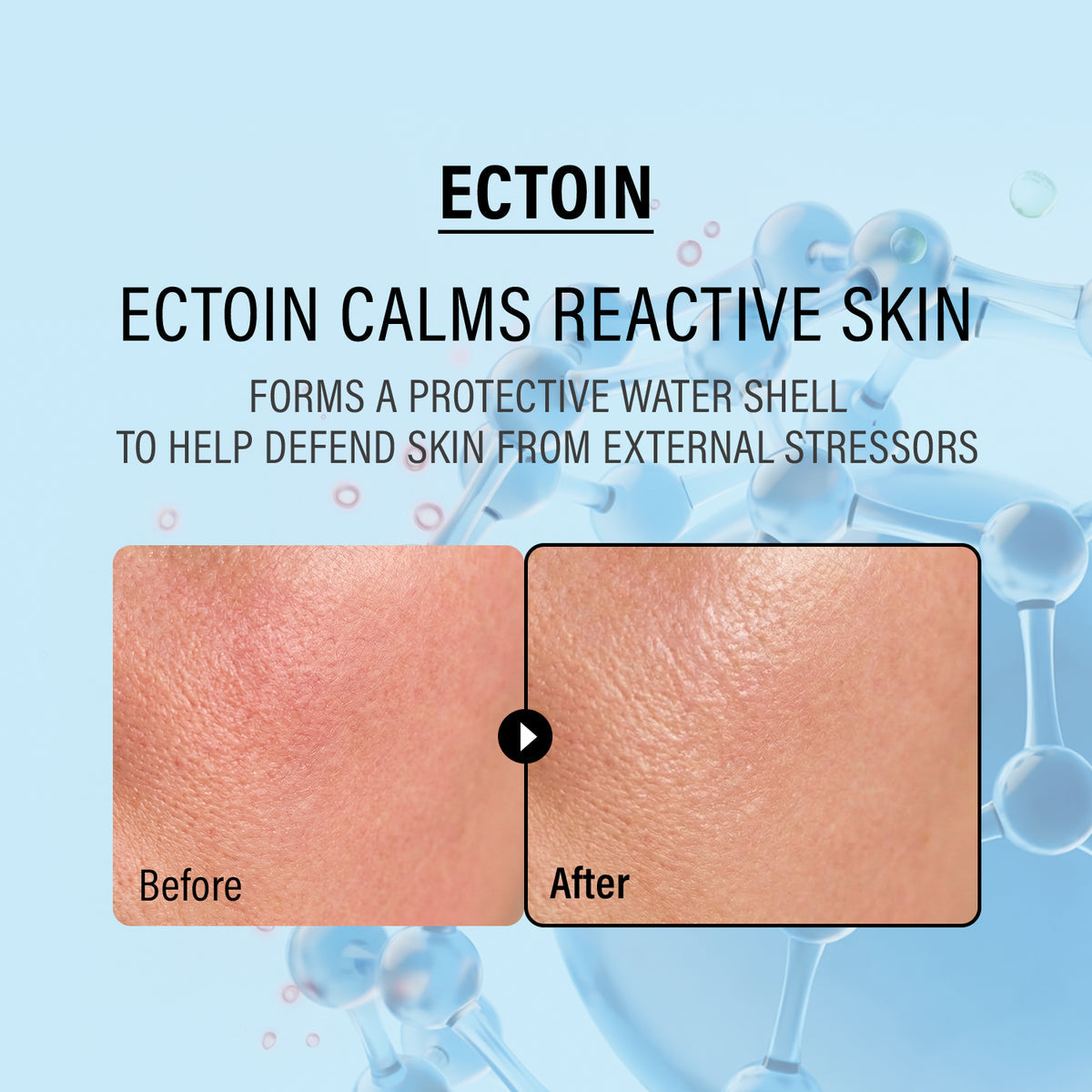 EPII DOUBLE UP CREAM ECTION & PANTHENOL 50ML