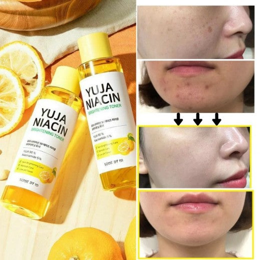 SOME BY MI TONER ÉCLAIRCISSANT YUJA NIACIN 150 ML
