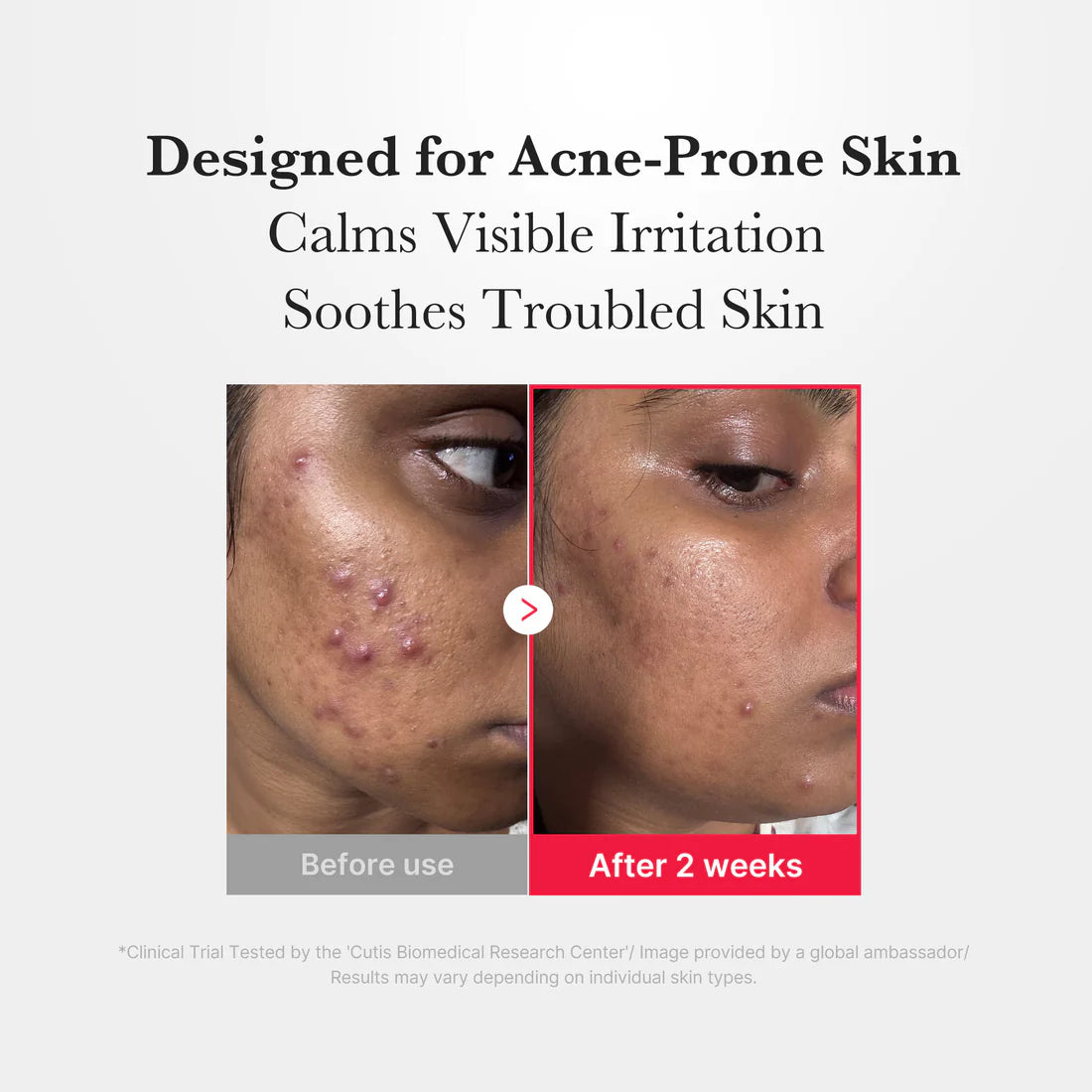 MEDICUBE HYPOCHLOROUS ACID POWER SOOTHING SPRAY 125ML