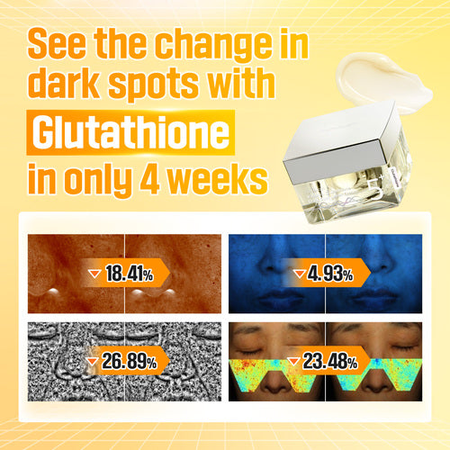 NUMBUZIN NO 5 VITAMIN GLUTATHIONE DARK SPOT LASER CREAM 50ML