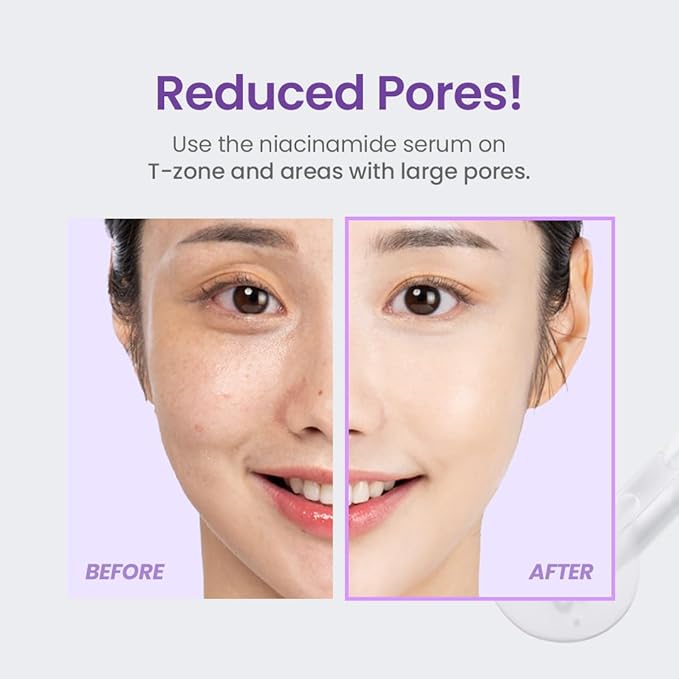 TIRTIR NIACINAMIDE 20% SERUM + RETINOL + GLUTATHIONE 30ML