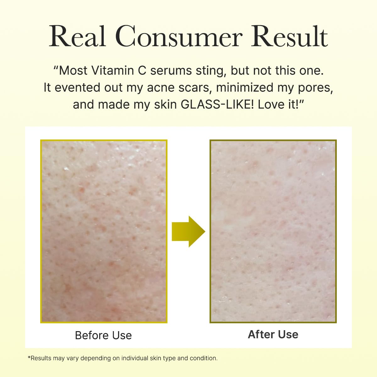 ARENCIA VITAMIN C BOOSTER SHOT SERUM 30ML (DAY)