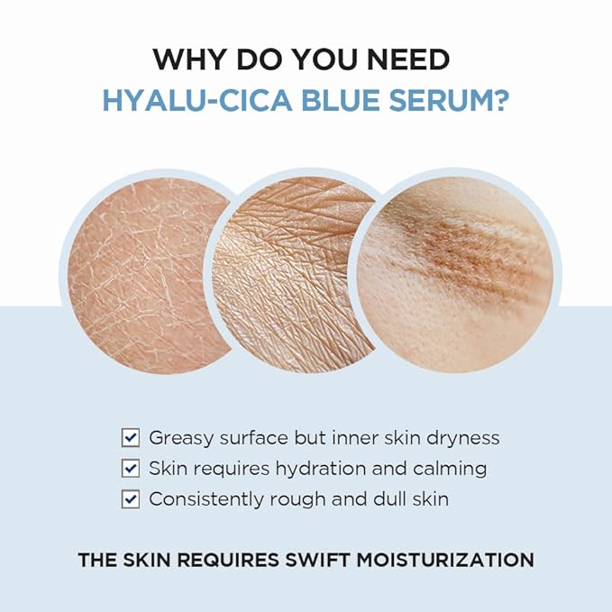 MADAGASCAR CENTELLA HYALU-CICA BLUE SERUM 30 ML