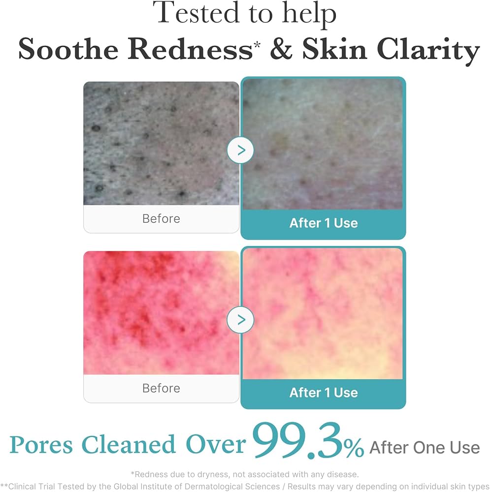 MEDICUBE AZELAIC ACID NIACINAMIDE DEEP CLEAN FOAM CLEANSER 120G