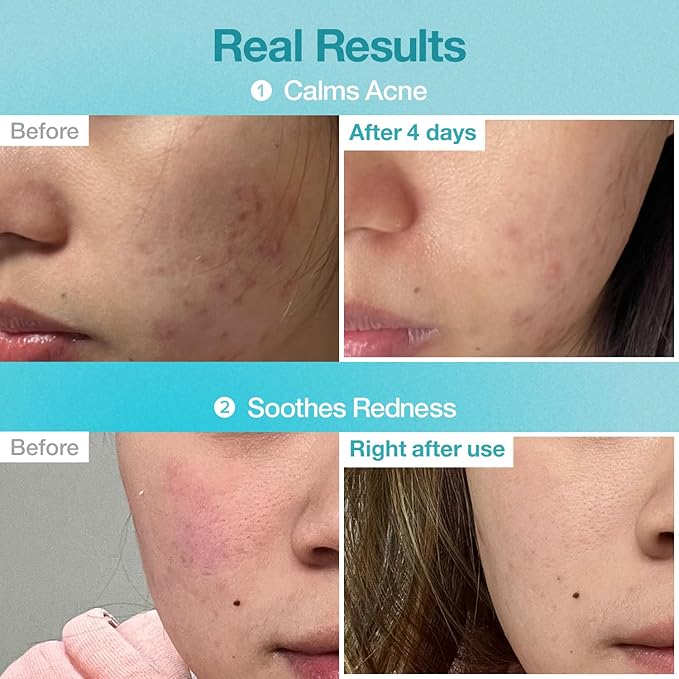 NUMBUZIN PANTOTHENIC B5 HYALURONIC ACTIVE CLEAR SHEET MASK